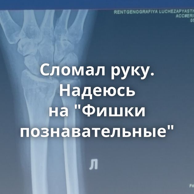 Сломал руку. Надеюсь на "Фишки познавательные"