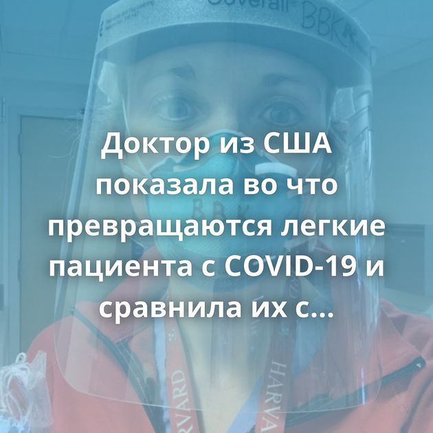 Доктор из США показала во что превращаются легкие пациента с COVID-19 и сравнила их с легкими курильщика и…