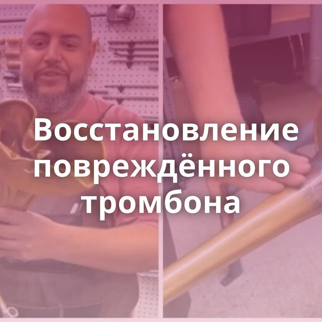 Восстановление повреждённого тромбона